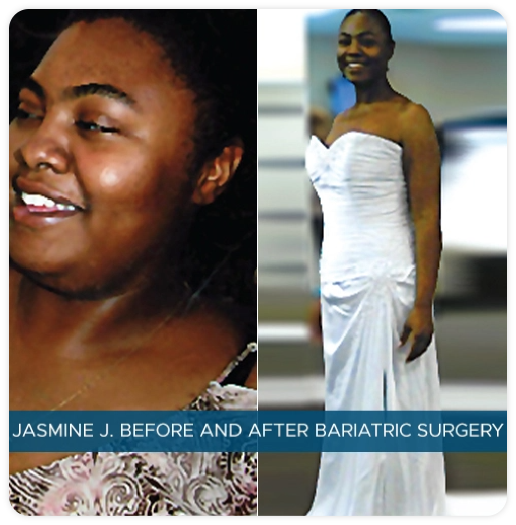 Jasmine J - Gastric Bypass Surgery