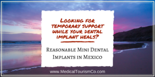 Mini Dental Implants in Mexico