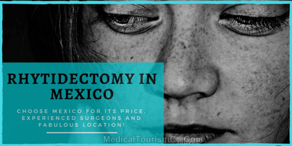 rhytidectomy-in-Mexico-1.jpg