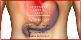 lap band in india
