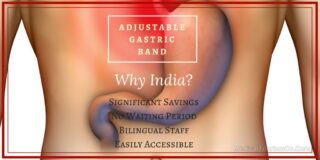 adjustable gastric banding in india