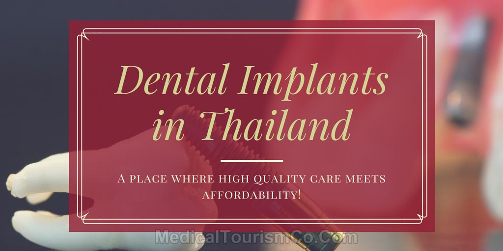 Dental-Implants-in-thailand.jpg