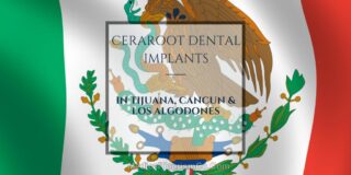 ceraroot implants in mexico