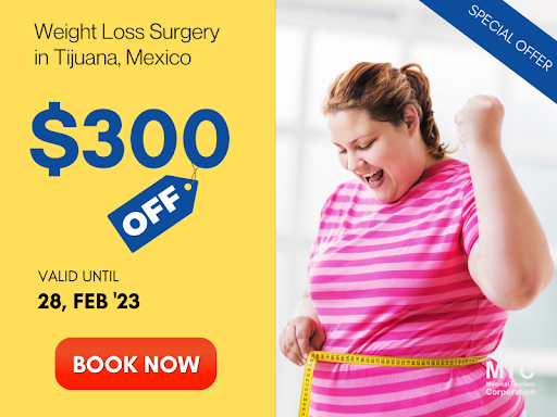 Before & After Gastric Sleeve Surgery in Mexico