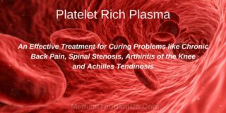 platelet-rich-plasma-therapy-mexico