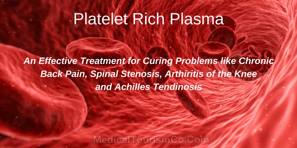 Platelet-Rich-Plasma-Therapy-in-Tijuana-Mexico.jpg