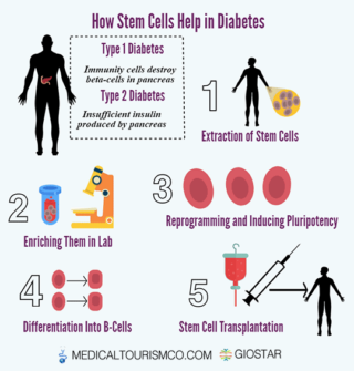 Stem-Cell-Therapy-for-Diabetes-in-Mexico-Infographic