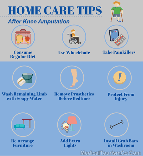 Home Care Tips Post Knee Amputation
