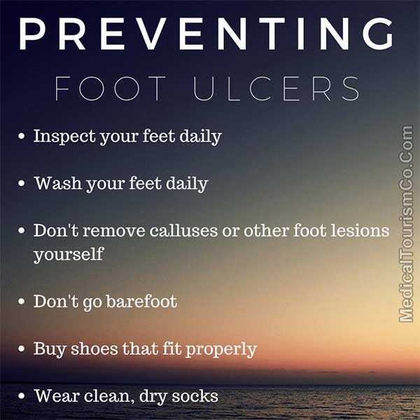 How To Prevent Foot Ulcers