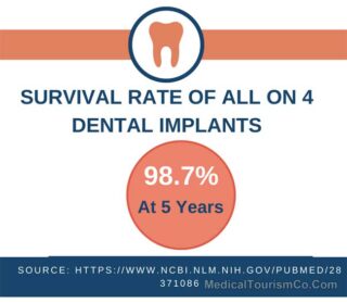 Survival Rate Of All-on-4 Dental Implants