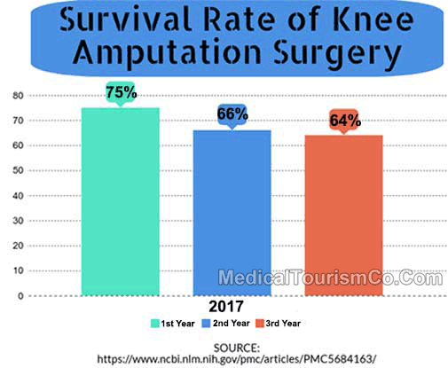 Survival Rate Of Knee Amputation Surgery