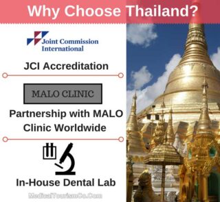Why Choose Thailand For All-on-4 Dental Implants