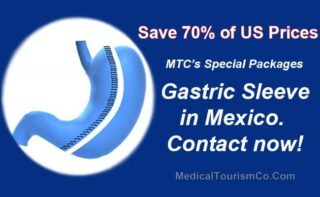 Gastric Sleeve in Mexico Discount