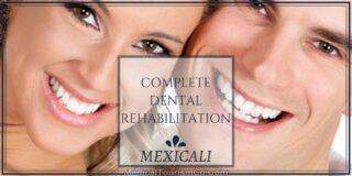 Full Mouth Restoration in Mexicali