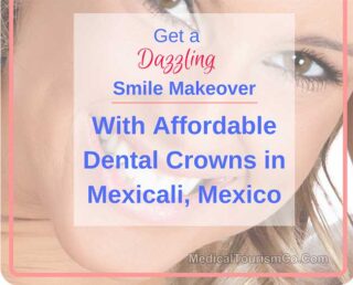 Dental Crowns in Mexicali Mexico