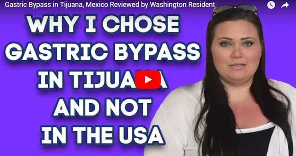 Why-I-Chose-gastric-Bypass-in-Tijuana.jpg
