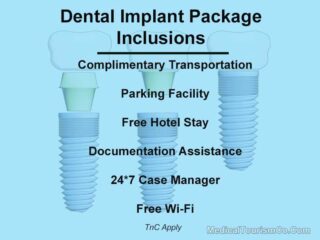 All-Inclusive Dental Implants Package
