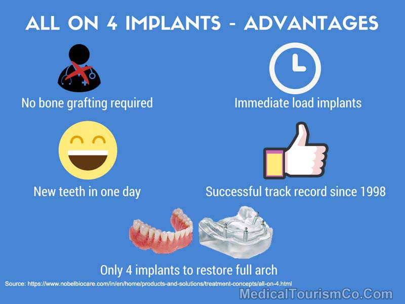 All-on-4 Implants - Advantages