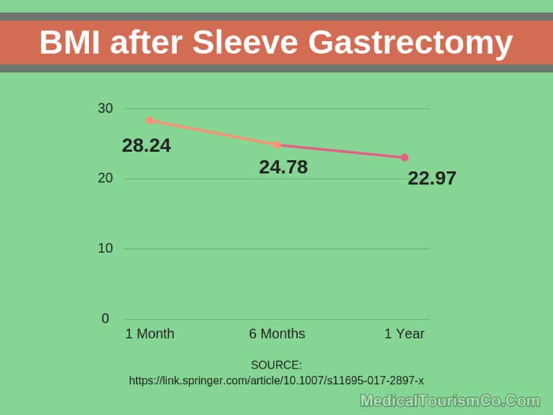 BMI After Sleeve Gastrectomy