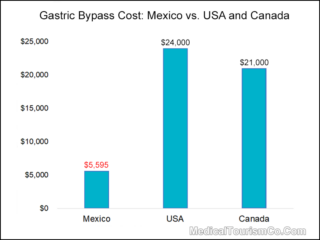 Gastric Bypass Cost Mexico USA Canada