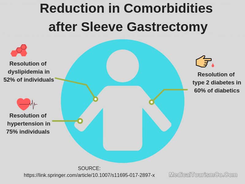 Reduction In Comorbidities After Gastric Sleeve Surgery