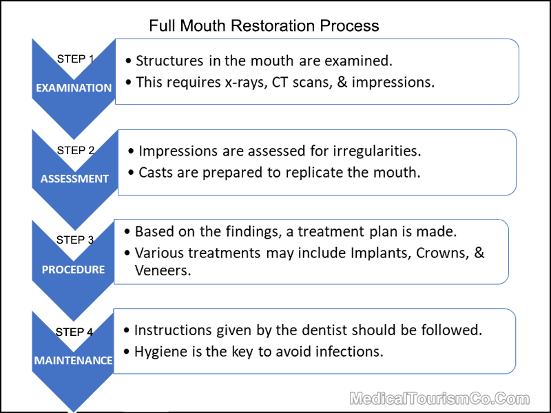 Full-Mouth-Implant-Restoration-Steps