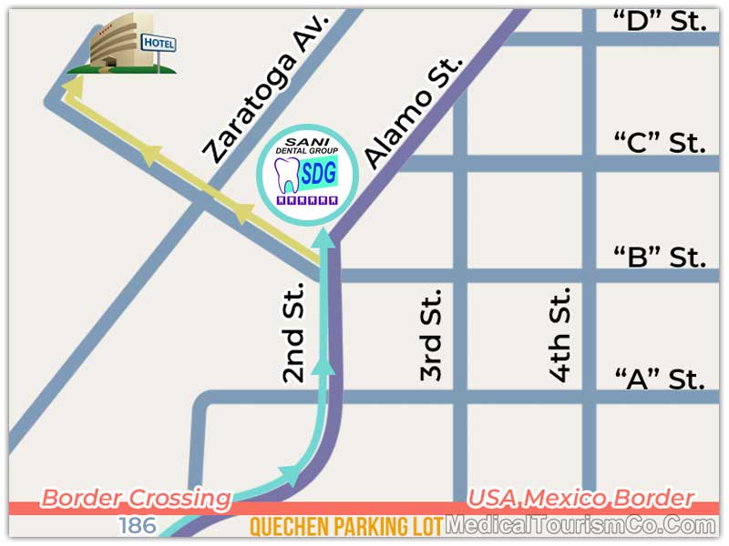 Los Algodones Dental Clinic Directions Map