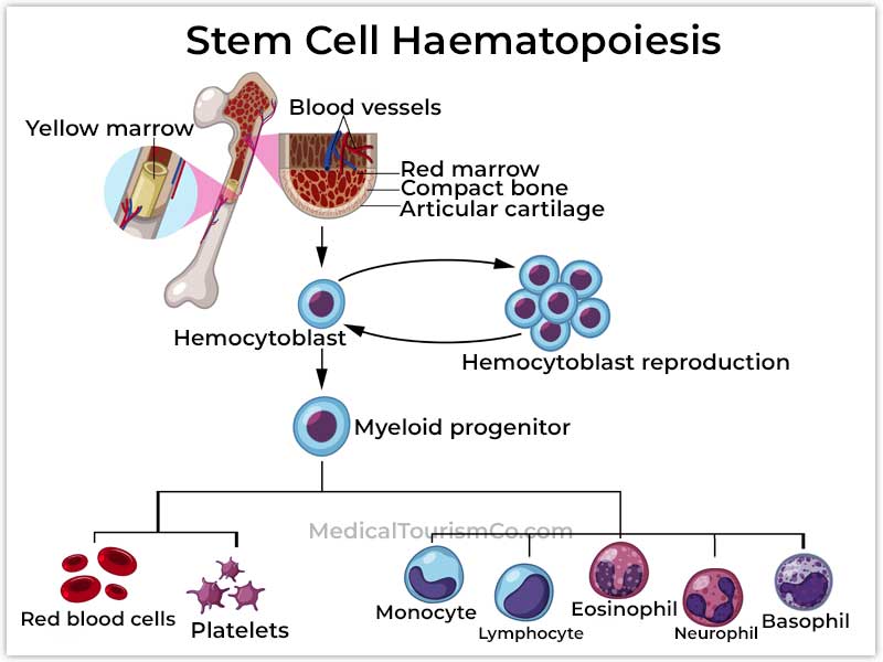 stem cell therapy for thalassemia in mexico