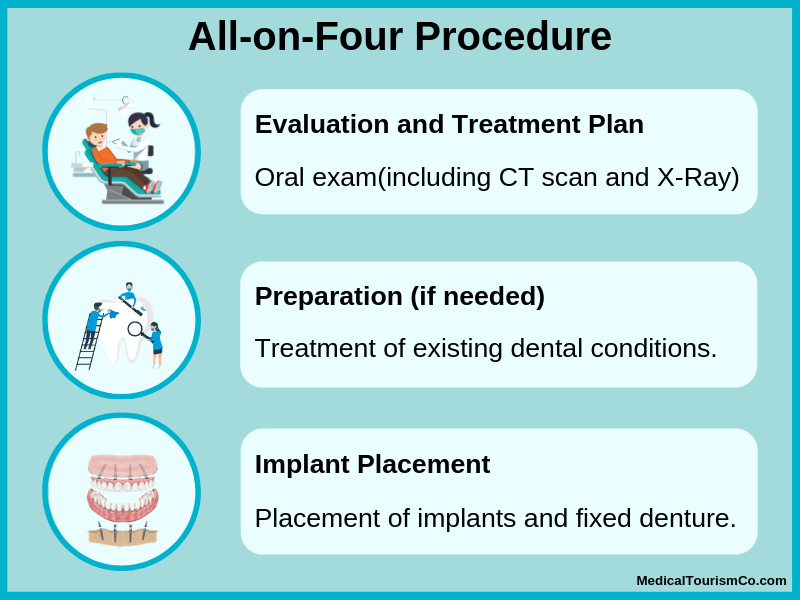 All-on-4 procedure in Colombia