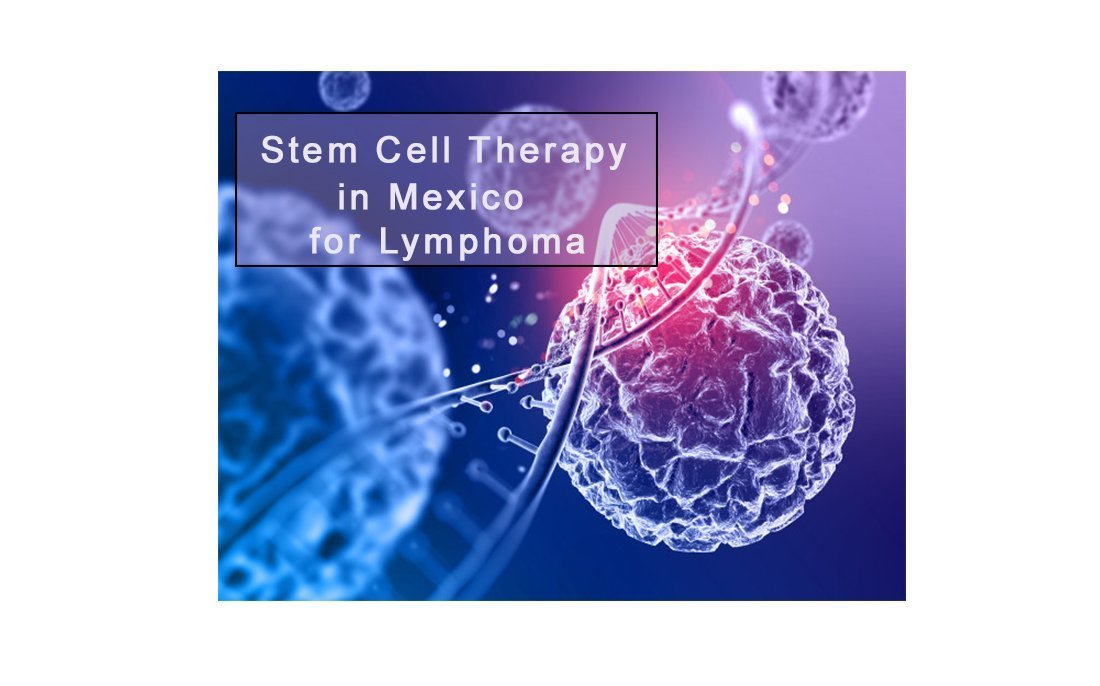 stem cell treatment for lymphoma