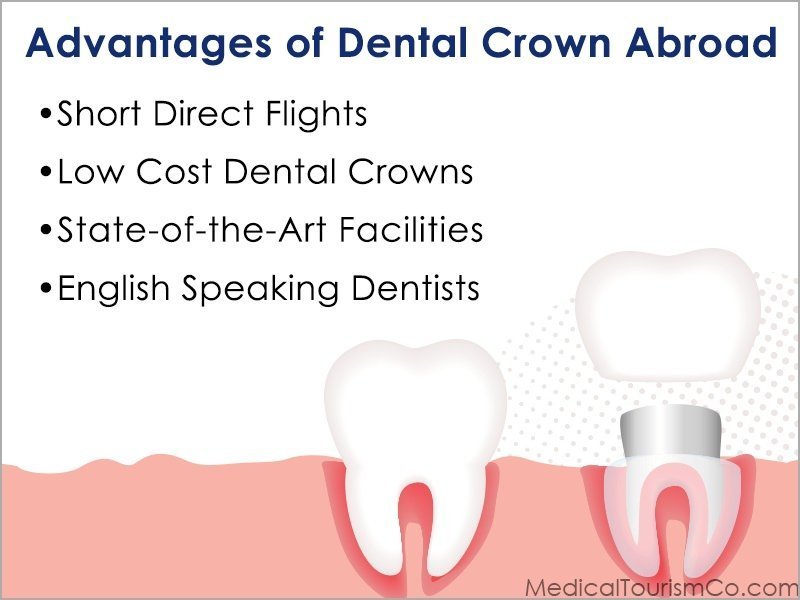Dental Crown Cost Abroad Mexico Costa Rica India Vietnam Colombia