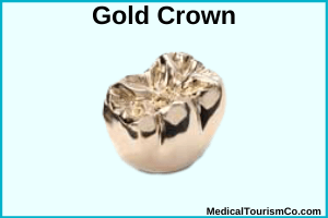 Gold crown abroad