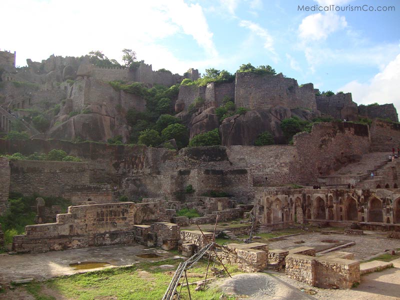 Golconda Fort | Dental Tourism in India