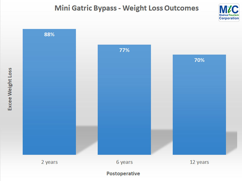 Mini Gastric Bypass Weight Loss Outcomes