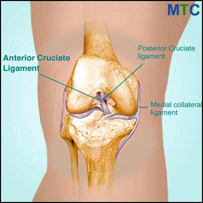 ACL knee replacement in Lithuania
