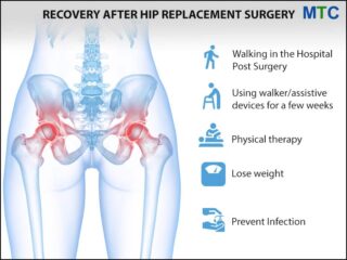 Hip replacement recovery