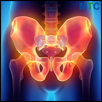 Anterior Approach to Hip Replacment