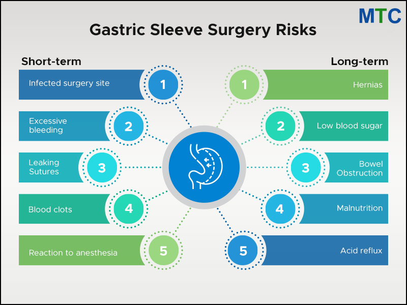 Gastric Sleeve Surgery Risks