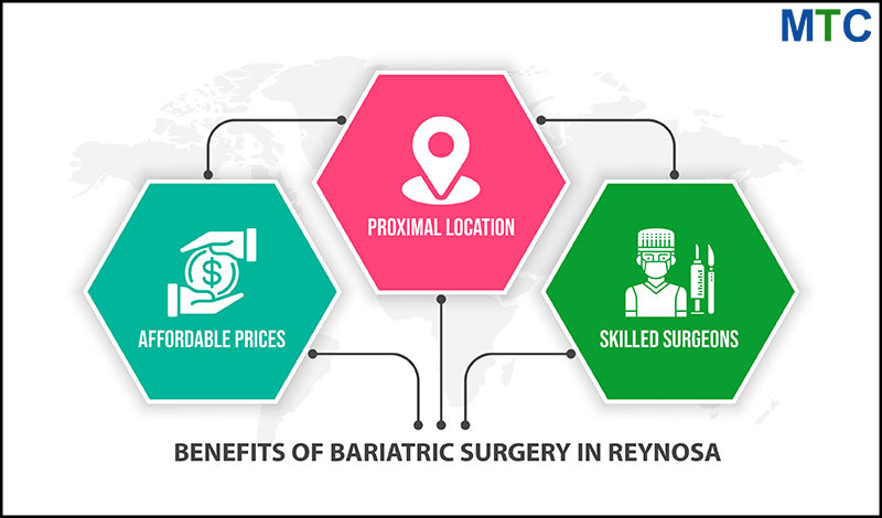 Benefits of Bariatric Surgery in Reynosa