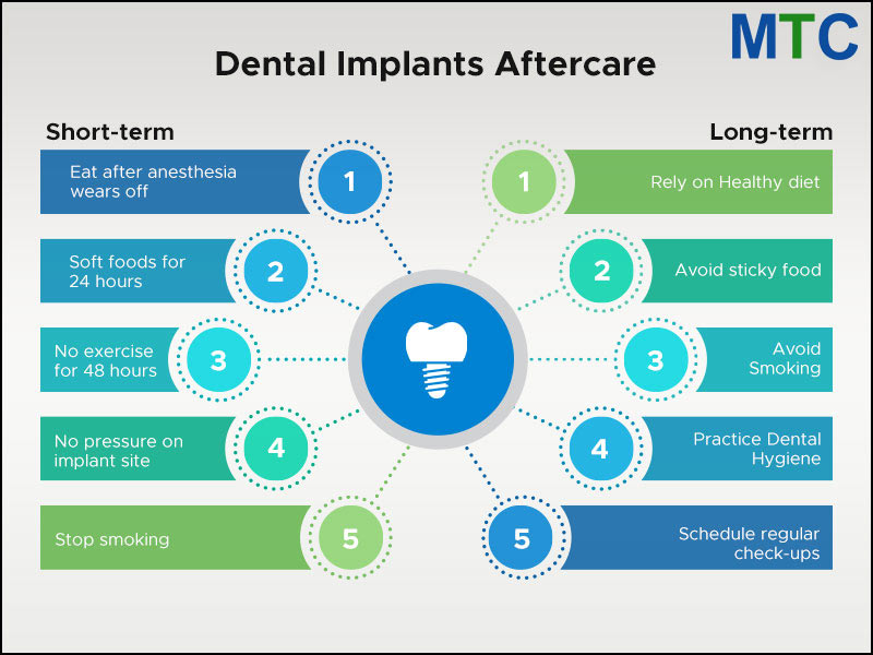 Short-Term & Long-Term Aftercare Tips for Implants