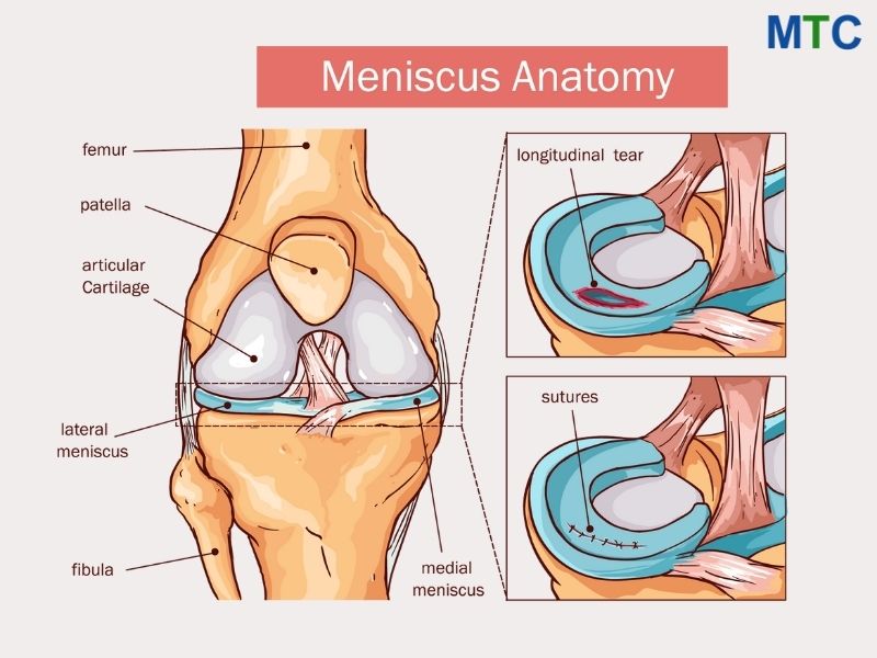 Meniscus Surgery - Anatomy