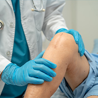 Knee Incision
