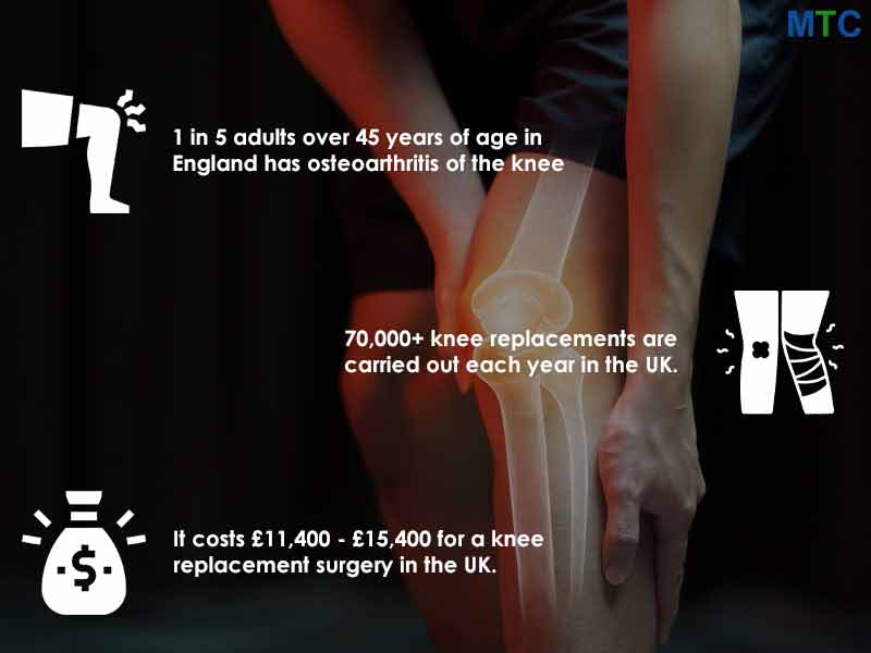 Status of Knee Surgery in UK