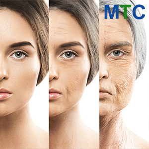 Stem Cells for Anti-Aging