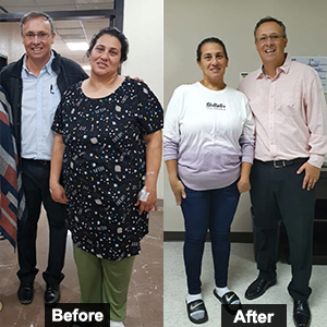 WLS in Cancun, Mexico - Before & after