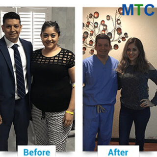 Bariatric surgery in Nuevo Laredo - Before & after