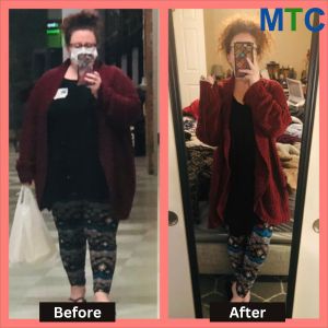 Janelle Woodburn | Before and After Weight Loss Surgery