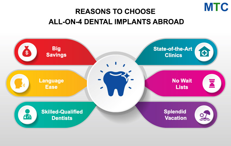 Reasons To Choose All on 4 Dental Implants Abroad