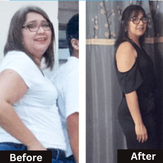 Ursula Reyez before and after gastric sleeve
