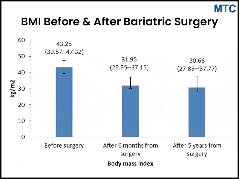 Graph With BMI Before & After Bariatric Surgery